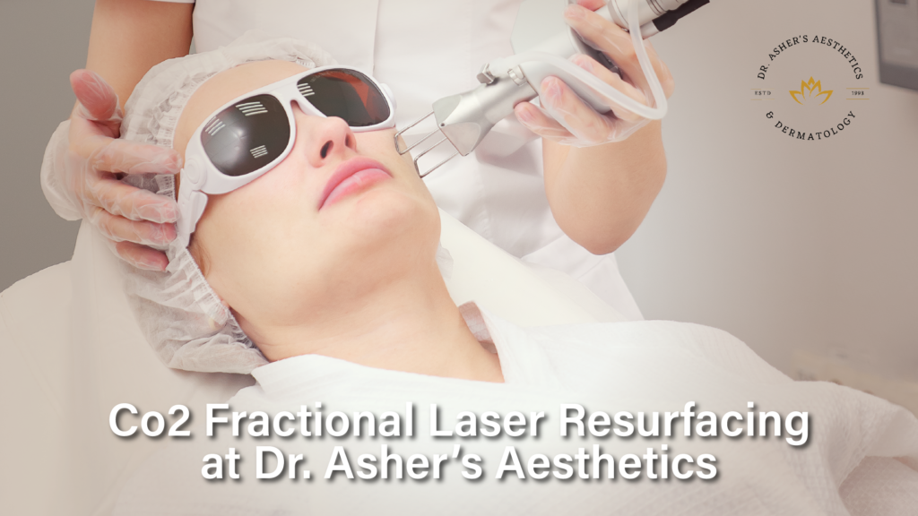 CO2 Laser Treatment in Rawalpindi