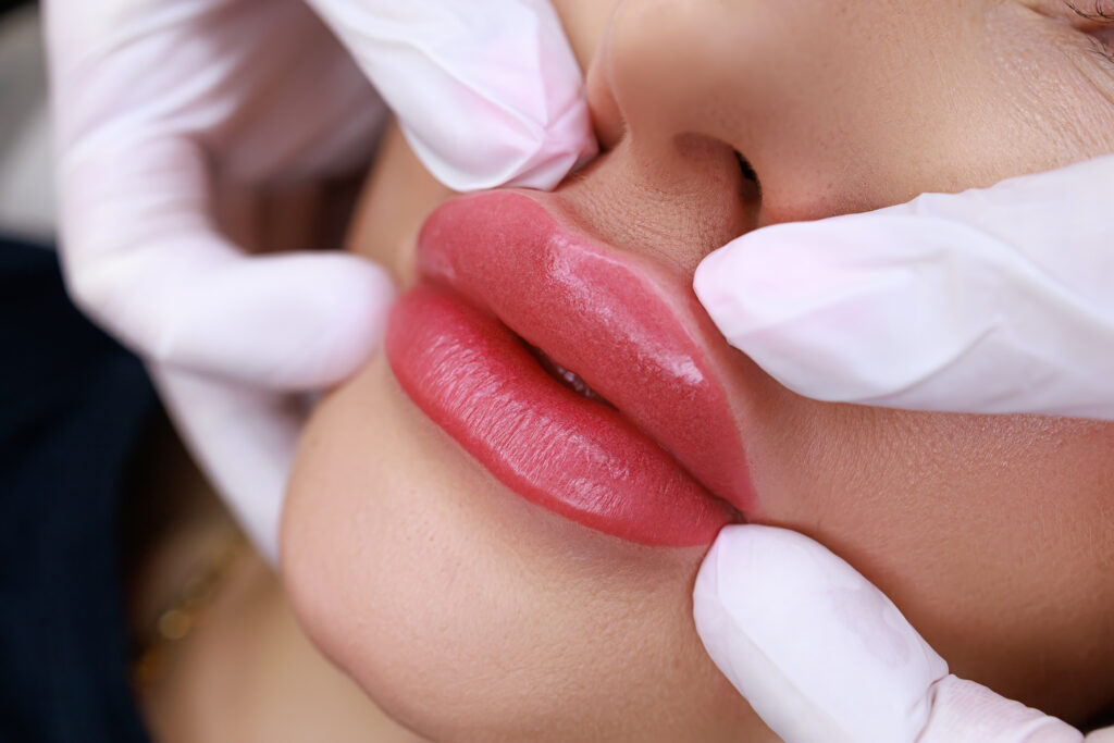 Lip fillers at Dr Asher's aesthetics
